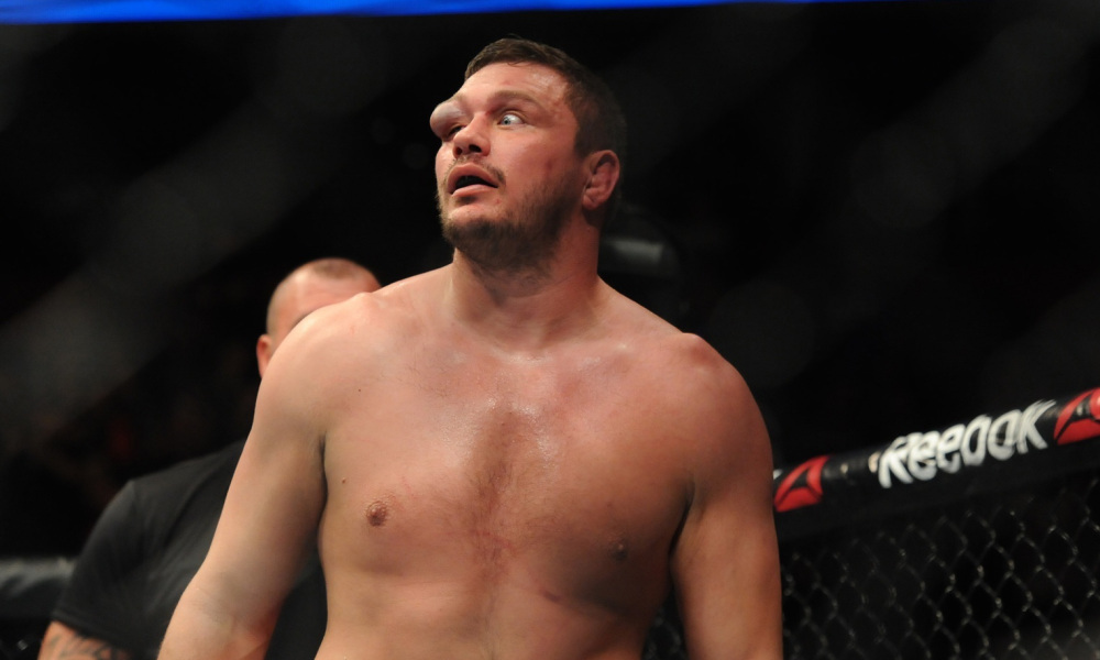 matt-mitrione-swollen-eye