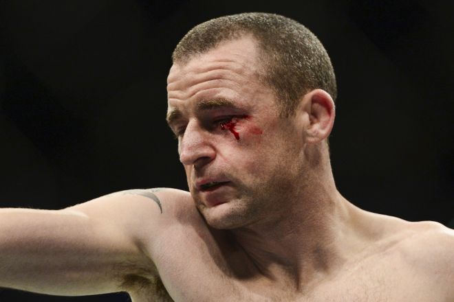 Jul 11, 2015; Las Vegas, NV, USA; Neil Seery bleeds from the eye against Louis Smolka (not pictured) during UFC 189 at MGM Grand Garden Arena. Smolka won via unanimous decision. Mandatory Credit: Joe Camporeale-USA TODAY Sports